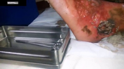 А Ноги, а ноги, а ноги мои ноги ...