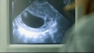 37f1f7c5f0fe4da0a4e4cb5c97155e73_yapfiles.ru