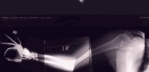 розвликаюцо