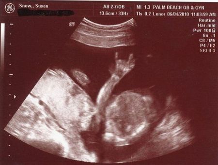 загруженное (7)