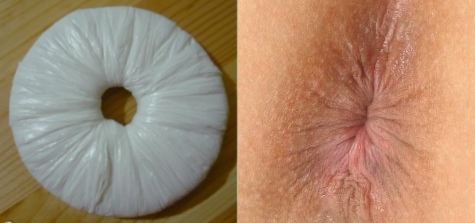 anus