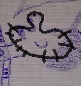 пц