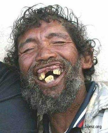 180853-2010.11.15-12.03.48-bomz.org-lol__prikol_zubastik