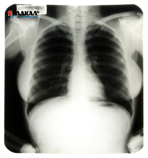 post-3-12715987007571