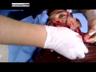 Царапнула осколком ...