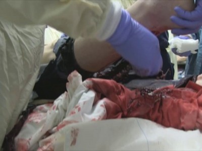 Поцарапал ногу немного ...