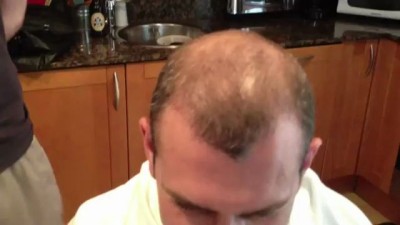 Девайс для лысеющих...