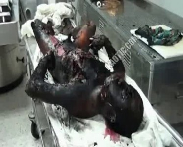 Burnt And Rotting Corpse...