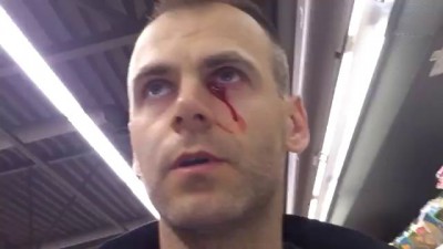 Травма глаза полученная в Maxima XX J. Smuuli tee 9 Tallinn