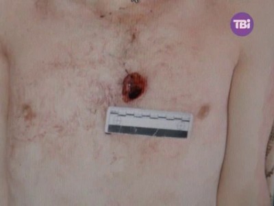 Тело Жизневски .