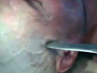 Вам в голову нож не прилетал?