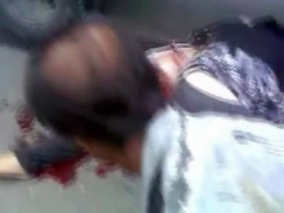 Ужасная травма