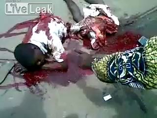 Человек разрезан пополам, но все еще жив