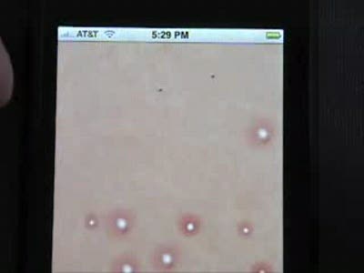 Давим прыщи на Ifone