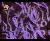 Как можно быть съеденным заживо