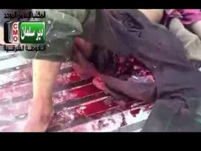 Покалечился немного