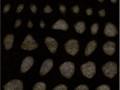 99