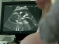 Doritos® Crash The Super Bowl Finalist - Ultrasound