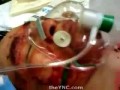 Gutted like a Fish in the Throat and Stomach, Trachea is Moving as he Breathes