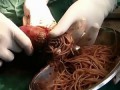 аскариды
