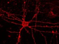 Tariq-Chohan1-MouseCortexNeuron